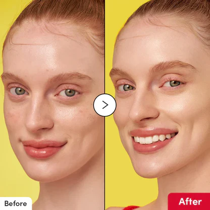 سرم ویتامینه ضد لک و روشن‌کننده اکوال بری Eqqualberry Vitamin Illuminating Serum