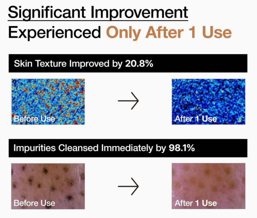 پودر شستشوی روشن کننده آنزیم برنج آنوا