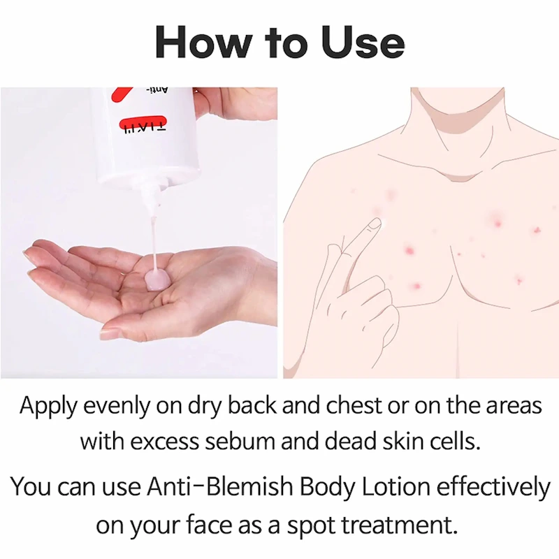 مرطوب کننده ضدجوش  لوسیون بدن تیام 200 میل