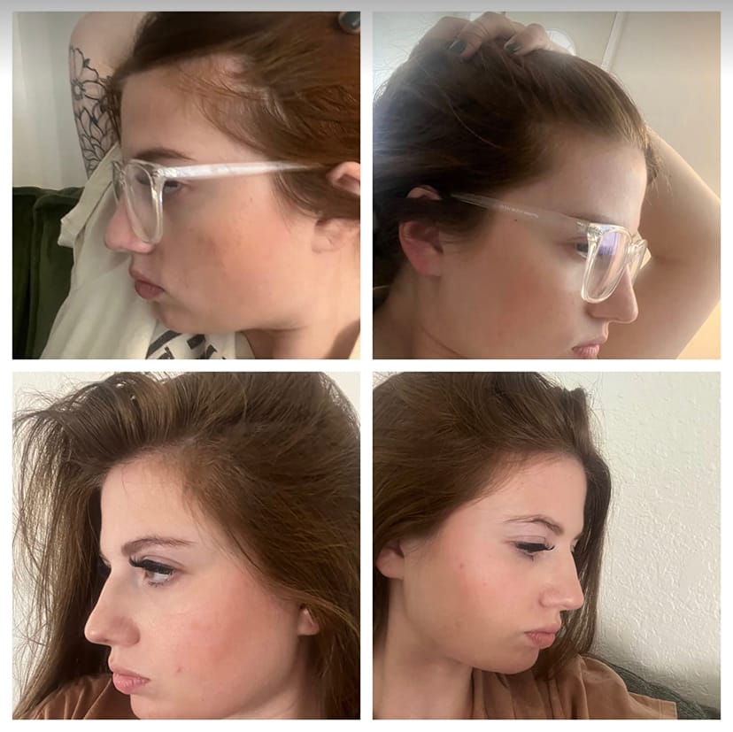 روغن ضد ریزش ورشد مجدد رزماری میله(ارجینال)