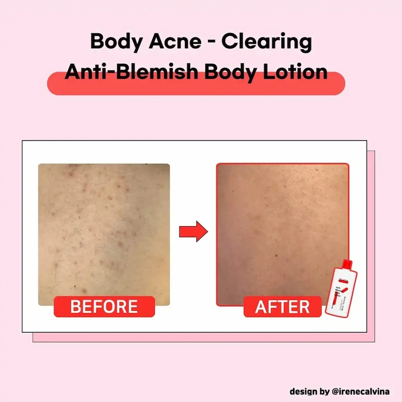 مرطوب کننده ضدجوش  لوسیون بدن تیام 200 میل